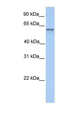 Western Blot: FAM13C1 Antibody [NBP1-56524]
