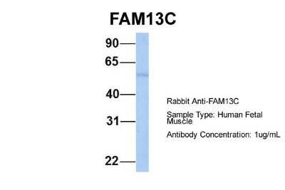 Western Blot: FAM13C1 Antibody [NBP1-56524]