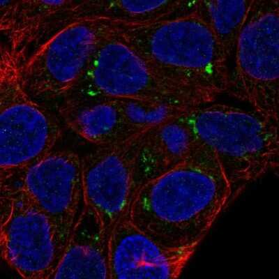 Immunocytochemistry/ Immunofluorescence: FAM149A Antibody [NBP2-68657]
