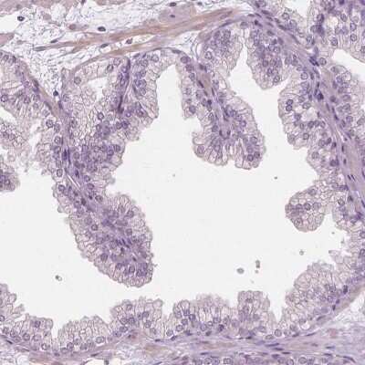 Immunohistochemistry-Paraffin: FAM154B Antibody [NBP1-90520]