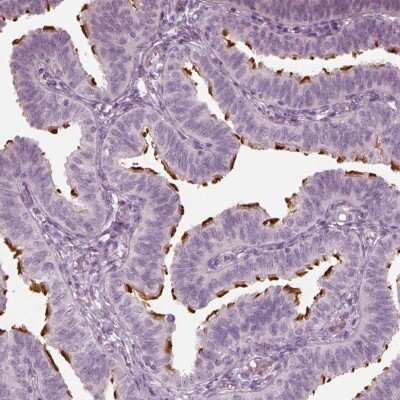 Immunohistochemistry-Paraffin: FAM154B Antibody [NBP1-90521]