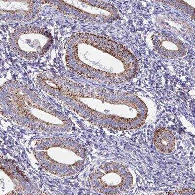 Immunohistochemistry: FAM156A Antibody [NBP2-46836]