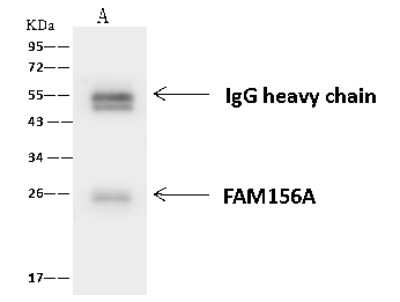 Immunoprecipitation: FAM156A Antibody [NBP2-97746]
