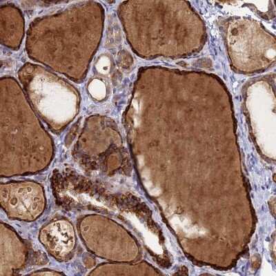 Immunohistochemistry-Paraffin: FAM160A1 Antibody [NBP1-93760]