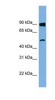 Western Blot: FAM160B1 Antibody [NBP1-57822]