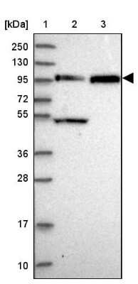Western Blot: FAM160B1 Antibody [NBP1-88970]
