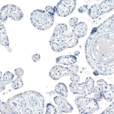 Immunohistochemistry-Paraffin: FAM161A Antibody [NBP1-94022]