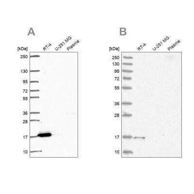 Western Blot: FAM162A Antibody [NBP2-58663]