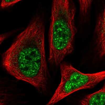 Immunocytochemistry/ Immunofluorescence: FAM164C Antibody [NBP2-47462]