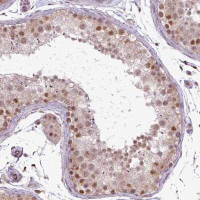 Immunohistochemistry-Paraffin: FAM164C Antibody [NBP2-47462]