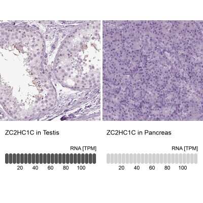 Immunohistochemistry-Paraffin: FAM164C Antibody [NBP2-62647]