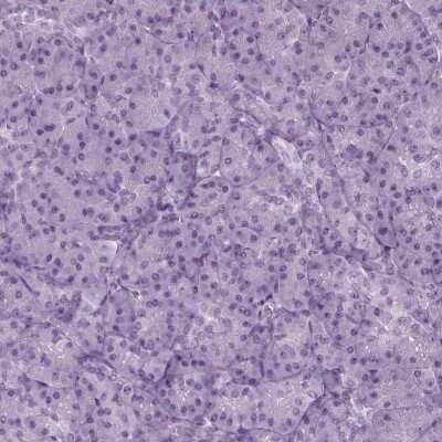 Immunohistochemistry-Paraffin: FAM164C Antibody [NBP2-62647]