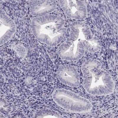 Immunohistochemistry-Paraffin: FAM166A Antibody [NBP1-90930]