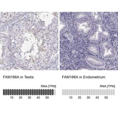 Immunohistochemistry-Paraffin: FAM166A Antibody [NBP1-90930]