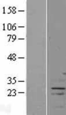 Western Blot: FAM166A Overexpression Lysate [NBP2-08951]