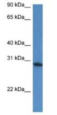 Western Blot: FAM168A Antibody [NBP1-74067]
