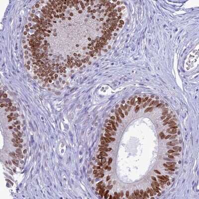 Immunohistochemistry-Paraffin: FAM169A Antibody [NBP1-93616]