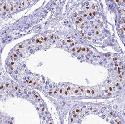 Immunohistochemistry-Paraffin: FAM169A Antibody [NBP1-93616]