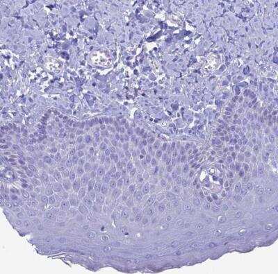 Immunohistochemistry-Paraffin: FAM169A Antibody [NBP1-93616]