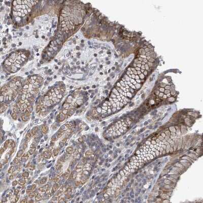 Immunohistochemistry-Paraffin: FAM171A1 Antibody [NBP2-13987]