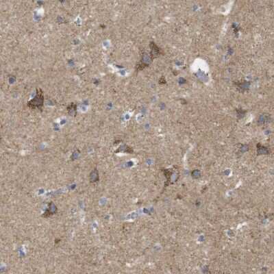 Immunohistochemistry-Paraffin: FAM171B Antibody [NBP1-93847]