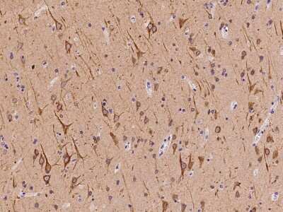 Immunohistochemistry-Paraffin: FAM171B Antibody [NBP2-97891]