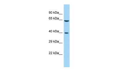 Western Blot: FAM172A Antibody [NBP2-84900]