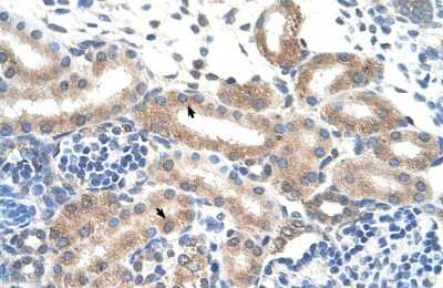 Immunohistochemistry-Paraffin: FAM174B Antibody [NBP1-91564]