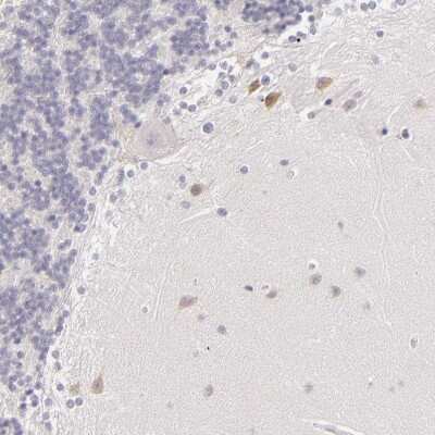 Immunohistochemistry-Paraffin: FAM181A Antibody [NBP1-90730]