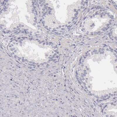 Immunohistochemistry-Paraffin: FAM181A Antibody [NBP1-90730]