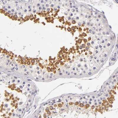 Immunohistochemistry-Paraffin: FAM181A Antibody [NBP1-90730]