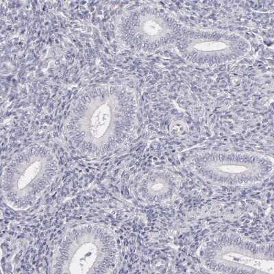 Immunohistochemistry-Paraffin: FAM181A Antibody [NBP1-90730]