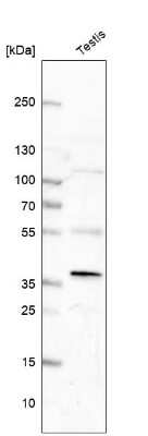 Western Blot: FAM181A Antibody [NBP1-90730]