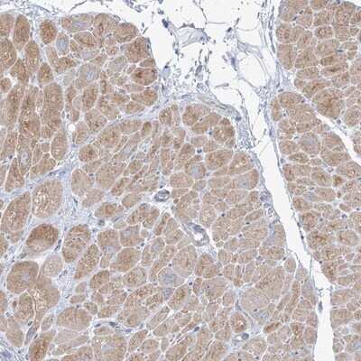 Immunohistochemistry-Paraffin: FAM184A Antibody [NBP1-86741]