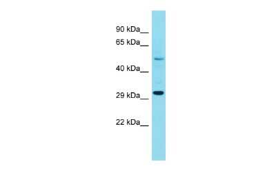 Western Blot: FAM185A Antibody [NBP2-84902]