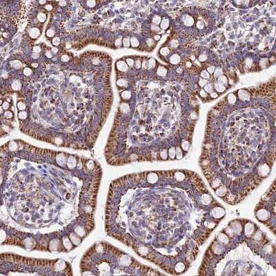 Immunohistochemistry-Paraffin: FAM186B Antibody [NBP1-88389]