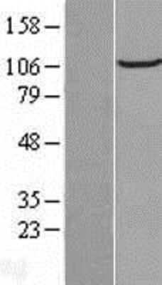 Western Blot: FAM186B Overexpression Lysate [NBL1-08131]