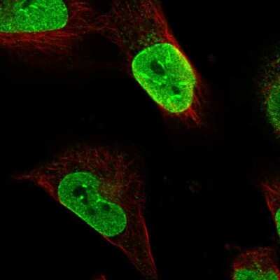 Immunocytochemistry/ Immunofluorescence: MINDY3 Antibody [NBP1-88543]