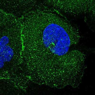 Immunocytochemistry/ Immunofluorescence: FAM193A Antibody [NBP1-91165]