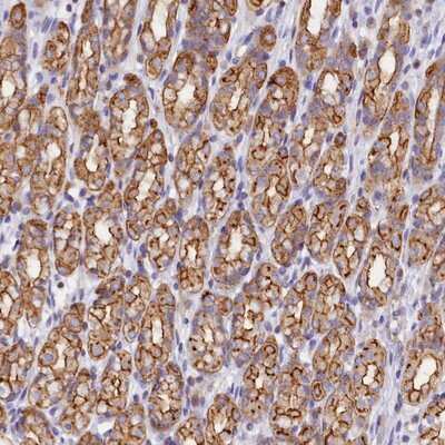 Immunohistochemistry-Paraffin: FAM193A Antibody [NBP1-91165]