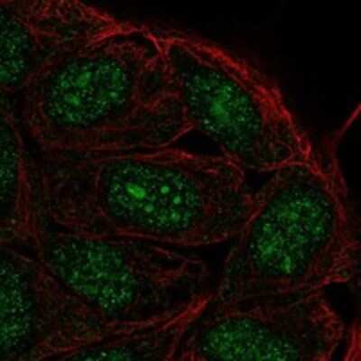 Immunocytochemistry/ Immunofluorescence: FAM193B Antibody [NBP3-17364]