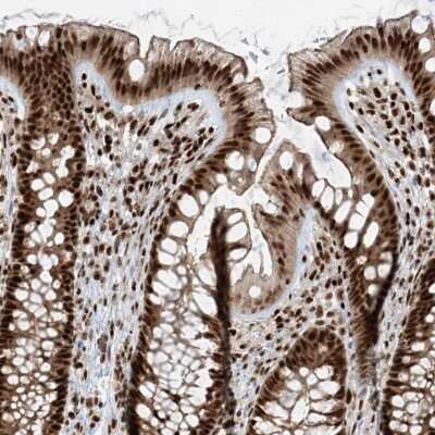 Immunohistochemistry-Paraffin: FAM193B Antibody [NBP1-90436]