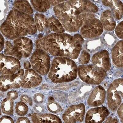 Immunohistochemistry-Paraffin: FAM194A Antibody [NBP2-14638]