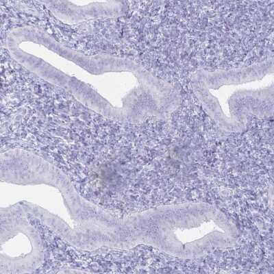 Immunohistochemistry-Paraffin: FAM194A Antibody [NBP2-14638]