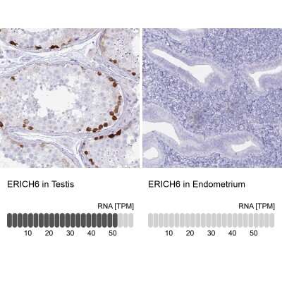 Immunohistochemistry-Paraffin: FAM194A Antibody [NBP2-14638]