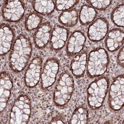 Immunohistochemistry-Paraffin: FAM204A Antibody [NBP1-90035]