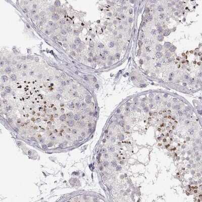 Immunohistochemistry-Paraffin: FAM205A Antibody [NBP2-56010]