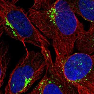 Immunocytochemistry/ Immunofluorescence: FAM207A Antibody [NBP1-90676]