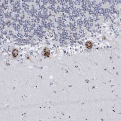 Immunohistochemistry-Paraffin: FAM207A Antibody [NBP1-90676]