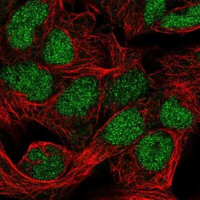 Immunocytochemistry/ Immunofluorescence: FAM208B Antibody [NBP2-56526]